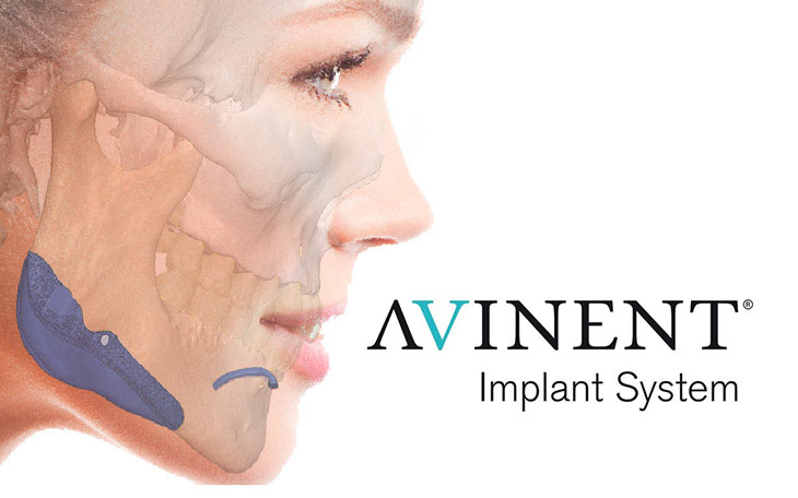 Prótesis Personalizadas Avinent Prótesis Personalizadas Avinent
